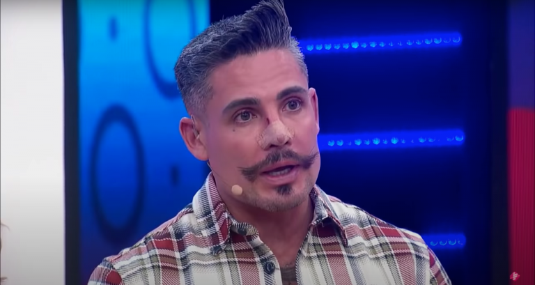 Adrián Cue reaparece luciendo completamente IRRECONOCIBLE tras nueva cirugía y quitarse el bigote