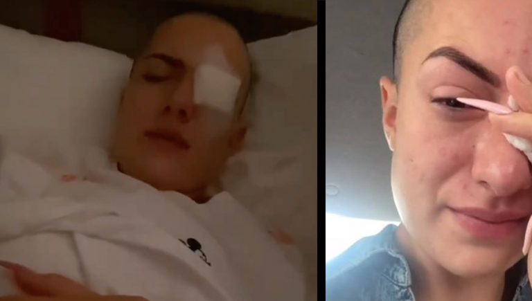 VIDEO: TikToker confunde gotas de los ojos con pegamento y termina en el hospital