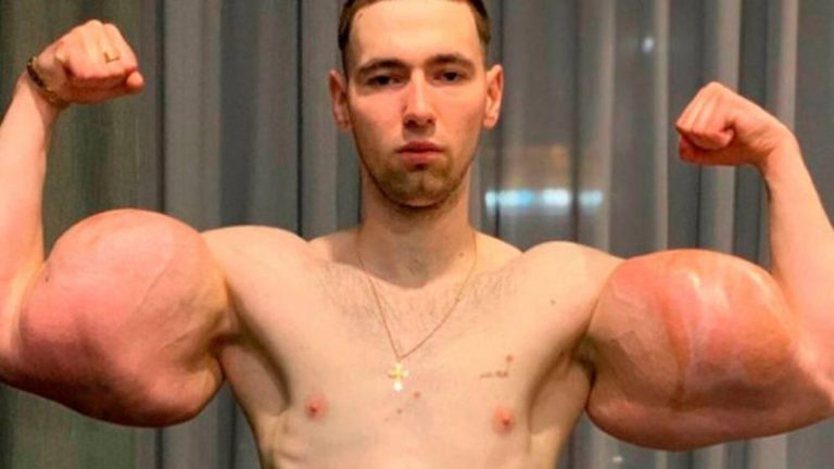 VIDEO: Explota brazo del “Popeye ruso” durante pelea de MMA