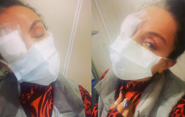 ¿Cuál es el estado de salud de Ivonne Montero tras quemar sus córneas con terrible accidente?