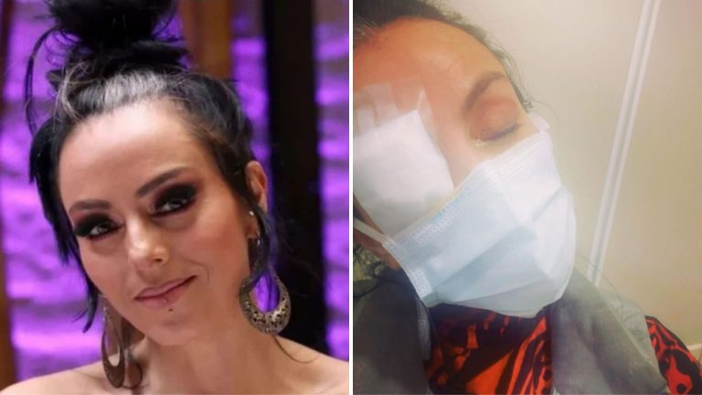 Ivonne Montero luce irreconocible tras sufrir accidente y quemarse las córneas