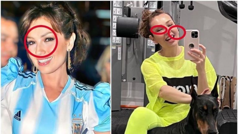 ¿Qué le pasó al rostro de Thalía?