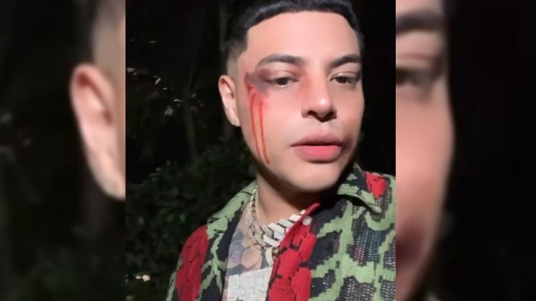 VIDEO: Eduin Caz preocupa al aparecer golpeado en redes