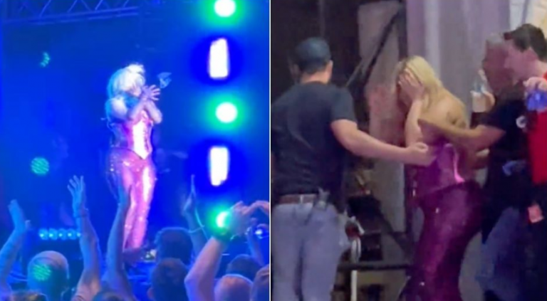 FOTOS: Así luce el rostro de Bebe Rexha tras ser golpeada en pleno show