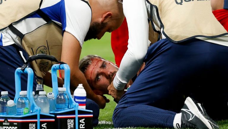 Antoine Griezmann comparte la fotografía de su oreja que casi le arrancan con Francia